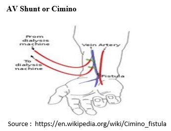 Cephalic vein - Wikipedia